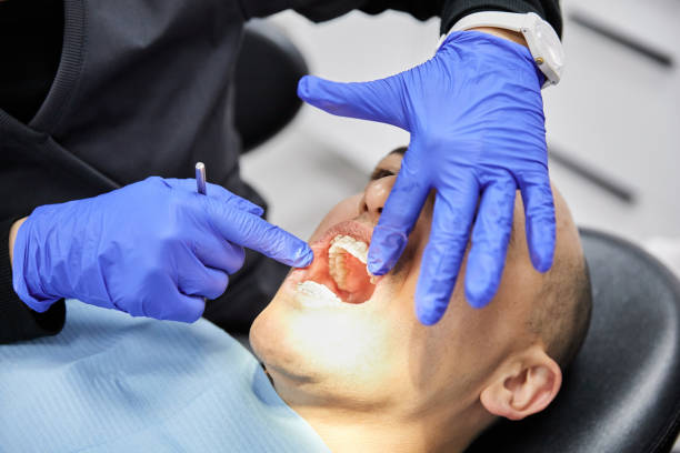 Best Emergency Treatment for Dental Infections or Abscesses in Elmwood, LA